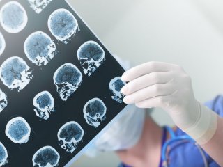 Компьютерная модель может обрабатывать разные источники клинических данных для прогнозирования возраста мозга