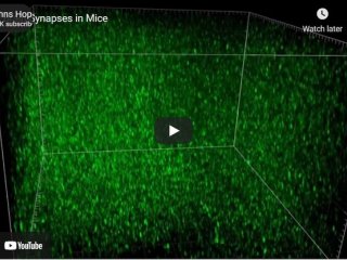Ученые рассмотрели миллионы связей между клетками мозга у мышей