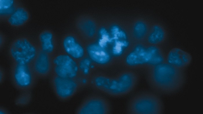 Найден способ стабилизировать хромосомы для борьбы с раком
