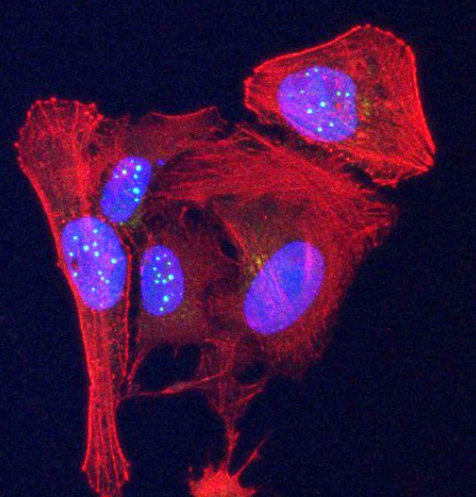 Теломеры на концах хромосом тоже могут производить белки