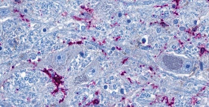 Поперечный разрез ствола головного мозга: нейроны (серо-голубой) находятся в тесном контакте с иммунными клетками (фиолетовый). Нитевидные синие структуры являются продолжениями нейронов, которые могут достигать самых отдаленных органов