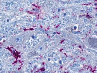 Поперечный разрез ствола головного мозга: нейроны (серо-голубой) находятся в тесном контакте с иммунными клетками (фиолетовый). Нитевидные синие структуры являются продолжениями нейронов, которые могут достигать самых отдаленных органов