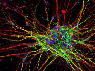 Нервные клетки людей с аутизмом очень быстро достигают больших размеров