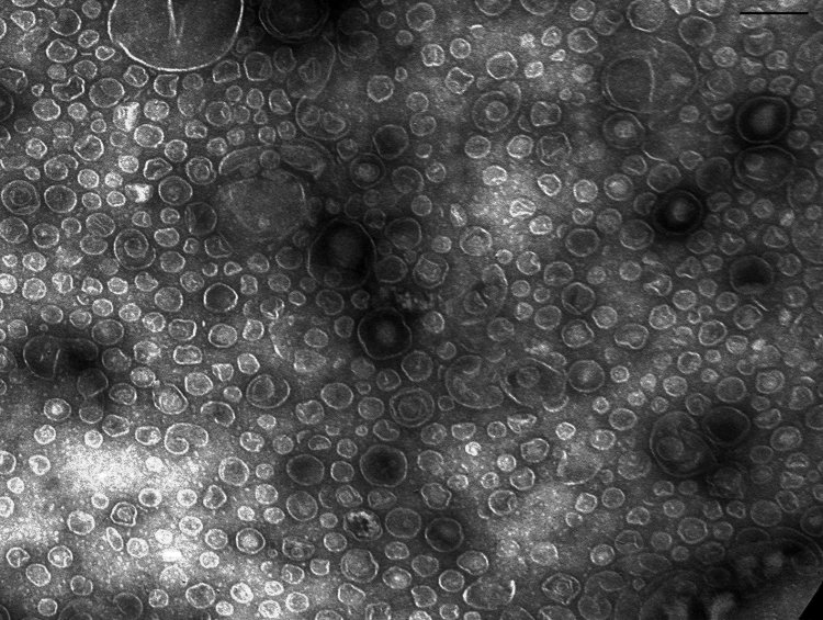 Фотография везикул Lysobacter sp. XL1, полученная методом просвечивающей электронной микроскопии
