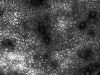 Рисунок 2. Фотография везикул Lysobacter sp. XL1, полученная методом просвечивающей электронной микроскопии