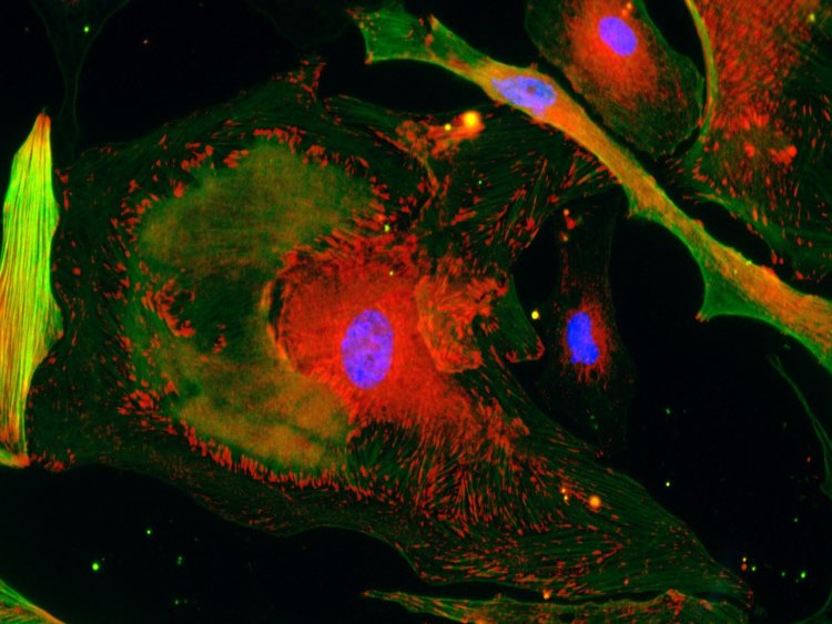 Микрофотография клеток соединительной ткани человека, дифференцировка которых меняется под влиянием внеклеточных везикул, секретированных клетками с отредактированными генами микроРНК. Источник: Наталия Басалова