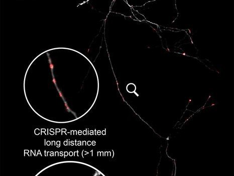 Изображение, демонстрирующее опосредованный CRISPR-перенос терапевтической РНК на большие расстояния для восстановления повреждённых нейронов головного мозга. Терапевтическая РНК отмечена красным. Фото: Mengting Han / Stanford University