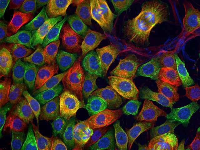 Сгенерированная картинка культуры клеток, похожих на наши. Источник Денис Никишин, биологический факультет МГУ