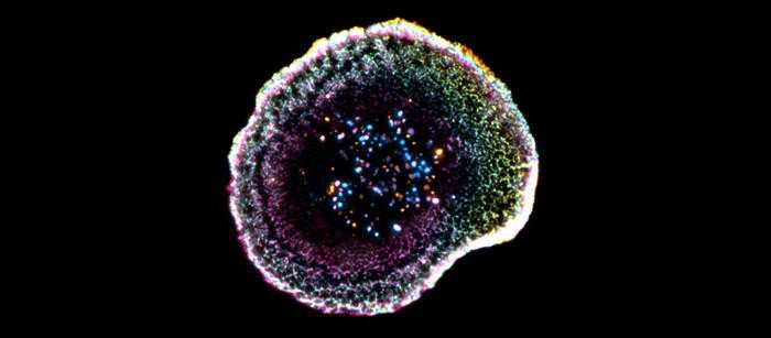 Цитотоксическая Т-клетка, полученная с помощью криоэкспансионной микроскопии (cryo-ExM). Цветные точки в центре — это цитотоксические гранулы, которые используются для уничтожения инфицированных или раковых клеток. Фото: @ F. Lemaitre @ UNIGE