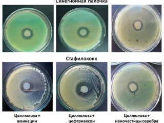 Ученые КНЦ СО РАН и СФУ разработали антимикробные пленки из бактериальной целлюлозы