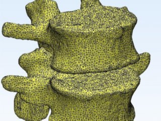 Иллюстрация: Конечно-элементная модель позвоночно-двигательного сегмента L4–L5 in vivo/Изображение авторов исследования