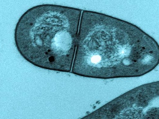 Mycobacterium spongiae под микроскопом. Фото: Pidot and team at the Doherty Institute