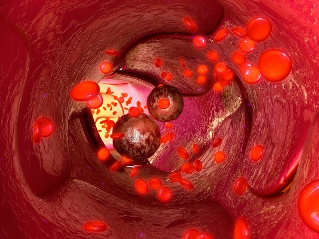 Фото: 7activestudio / ru.123rf.com