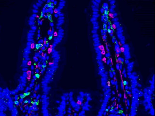 Микроскопическое изображение слизистой оболочки кишечника мыши, на котором видны CD4 (зелёный), CD8 (пурпурный) и DAPI (синий). Фото: Ludivine Bersier (2025) / University of Lausanne