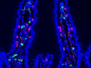 Микроскопическое изображение слизистой оболочки кишечника мыши, на котором видны CD4 (зелёный), CD8 (пурпурный) и DAPI (синий). Фото: Ludivine Bersier (2025) / University of Lausanne