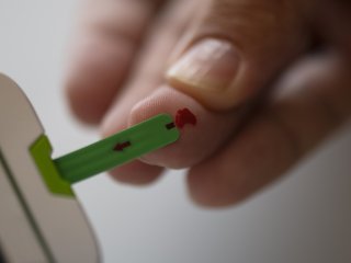 Экспресс-тест на мелатонин поможет отслеживать биоритмы человека. Фото: Freepik.com