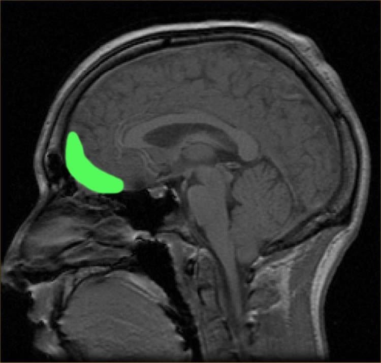 МРТ-сканер распознает эмоции людей