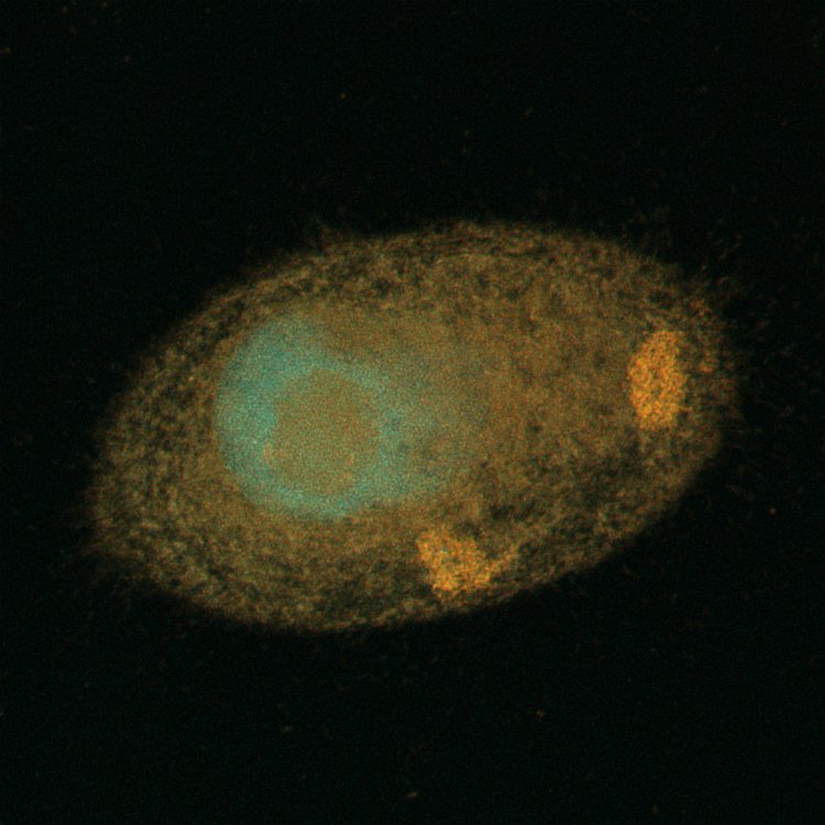 Изображение инфузории с симбионтами, полученное методом конфокальной микроскопии. Желтый сигнал показывает расположение скоплений бактерий в цитоплазме. Источник: Алексей Потехин