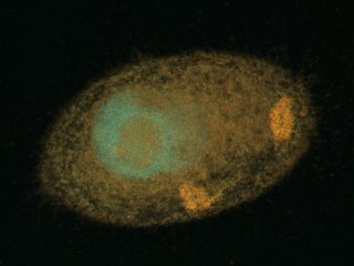Рисунок 1. Изображение инфузории с симбионтами, полученное методом конфокальной микроскопии.