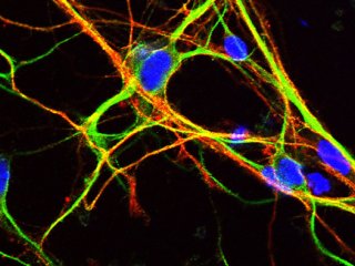 Некоторые некодирующие РНК помогают регулировать функцию нервных клеток 