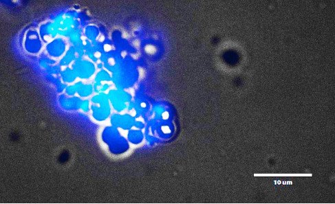Фото одной из эндемичных бактерий, выделенной из экстремофильного микробного сообщества БНО ИЯИ РАН. © ОИЯИ