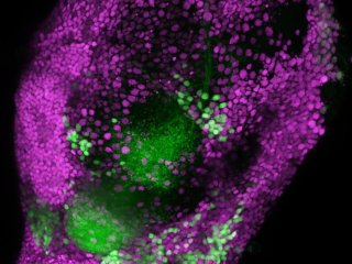 Нейроны латерального коленчатого тела с оптогенетической меткой (зелёные) в море нейронов головного мозга (пурпурные). Фото: RIKEN / Hokto Kazama