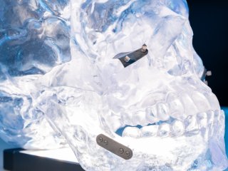 Модель установки пары «винт–пластина» для остеосинтеза и барьерной мембраны для челюстно-лицевой хирургии. Фото: Сергей Гнусков / пресс-служба Университета МИСИС