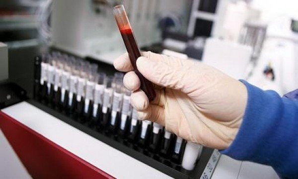 Выявлять состав кишечной микрофлоры научились по анализу крови