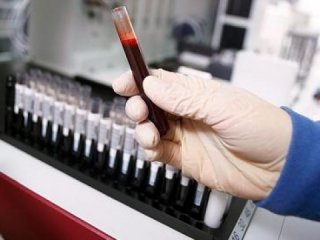 Выявлять состав кишечной микрофлоры научились по анализу крови