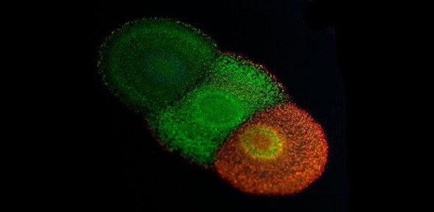 Ученые нашли у бактерий гены цветов павлиньего хвоста