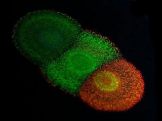 Ученые нашли у бактерий гены цветов павлиньего хвоста