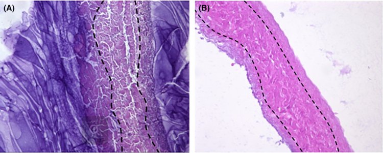 Микрофотографии синтезированных биоматериалов на основе: а) перикарда; б) глиссоновой капсулы печени.