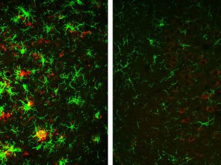 Неактивность фермента избавила мозг мышей от белковых бляшек