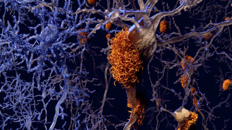 Болезнь Альцгеймера меняет реакцию мышей на изменение сахара в крови