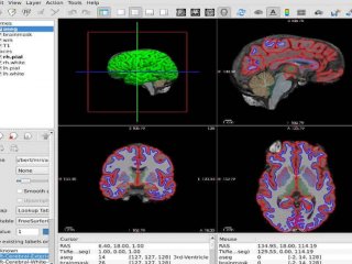 Интеллектуальная система хранения и обработки нейробиологических данных