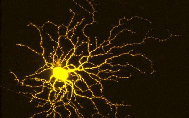 Исследователи находят ключ к тому, как защитить нейроны и стимулировать их рост.