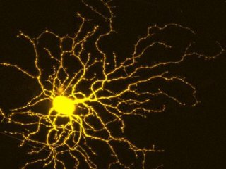 Исследователи находят ключ к тому, как защитить нейроны и стимулировать их рост.