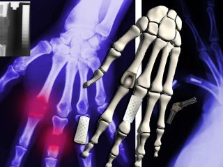 Полный цикл создания биоразлагаемых костных имплантатов реализовали в ТПУ. Фото: Андрей Ашрафов / ТПУ