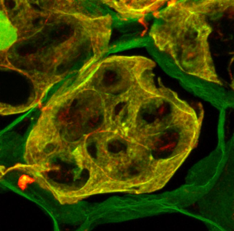Колокализация сигнала антител против вицилина (красный) с амилоид-специфичным красителем тиофлавином-Т (зеленый) на криосрезах семян гороха. Колокализация показана желтым цветом. Источник: Antonets et al., PLOS Biology, 2020