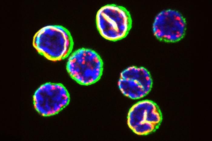 Т-клетки из крови здорового человека-донора. Ядерные компоненты (красный, желтый и синий) и Т-клеточные рецепторы (зеленый) подчеркивают удивительную вариабельность субклеточной пространственной организации наших Т-клеток. Фото: Ben Hale / ETH Zurich