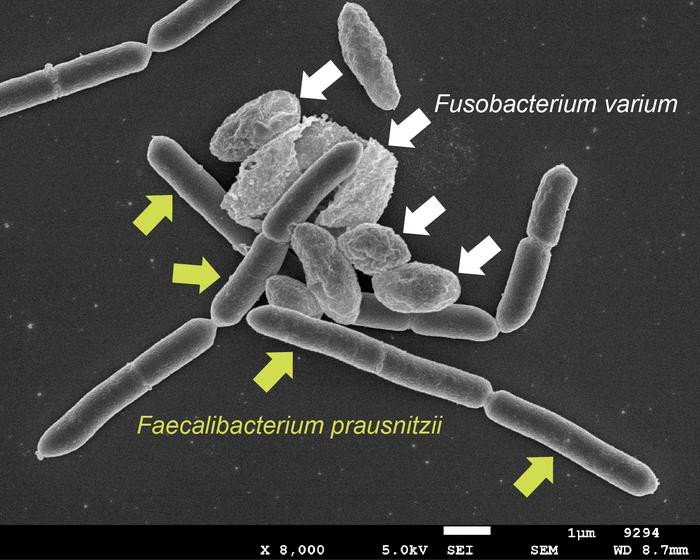 Fusobacterium varium и Faecalibacterium prausnitzii демонстрируют межклеточный контакт. Фото: Koji Hosomi / Osaka Metropolitan University
