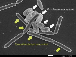 Fusobacterium varium и Faecalibacterium prausnitzii демонстрируют межклеточный контакт. Фото: Koji Hosomi / Osaka Metropolitan University