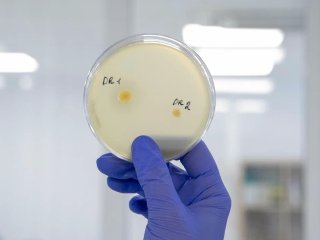 Внешний вид колоний пробиотических штаммов на плотной питательной среде. Фото из архива информационной службы факультета «Агропромышленный» ДГТУ