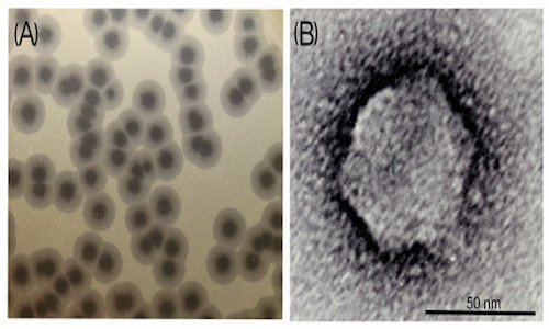 Popova, A.V.; Lavysh, D.G.; Klimuk, E.I.; Edelstein, M.V.; Bogun, A.G.; Shneider, M.M.; Goncharov, A.E.; Leonov, S.V.; Severinov, K.V. Novel Fri1-like Viruses Infecting Acinetobacter baumannii—vB_AbaP_AS11 and vB_AbaP_AS12—Characterization, Comparative Ge