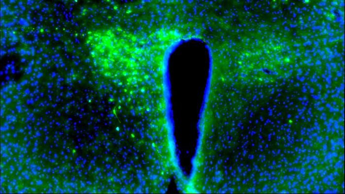 Лаборатория Борнигера обнаружила, что при раке молочной железы нейроны (зелёные) в области гипоталамуса мыши, называемой паравентрикулярным ядром (ПВЯ), переходят в гиперактивное состояние. Фото: Borniger lab/CSHL