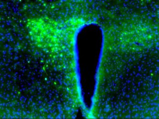 Лаборатория Борнигера обнаружила, что при раке молочной железы нейроны (зелёные) в области гипоталамуса мыши, называемой паравентрикулярным ядром (ПВЯ), переходят в гиперактивное состояние. Фото: Borniger lab/CSHL