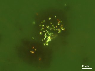 Новый род бактерий Parvivirga в новом порядке Anaerosomatales ранее некультивируемой группы OPB41. Эта бактерия составляет до 7% в микробном сообществе водоносного горизонта, откуда добываются воды типа «Ессентуки № 4». Фото: ФИЦ Биотехнологии РАН
