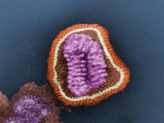 Ренгеновский снимок показал, как антитела седлают вирус гриппа