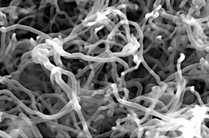 Как соединить нервную ткань с помощью углеродных нанотрубок
