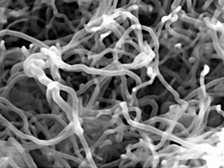 Как соединить нервную ткань с помощью углеродных нанотрубок